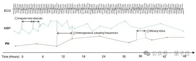 微软发布医疗时序基座模型:4540亿数据预训练,解决不规则采样
