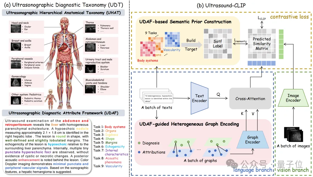 36.4万超声图文对!中国团队构建首个大规模超声专属数据集,让AI真正读懂临床诊断语义丨CVPR’26